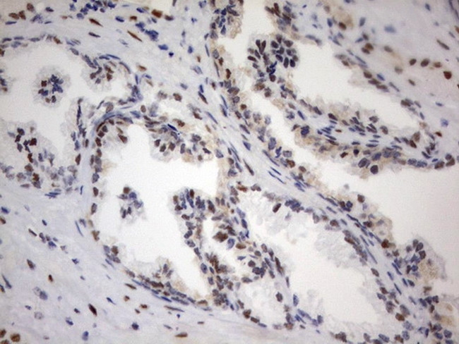 PARN Antibody in Immunohistochemistry (Paraffin) (IHC (P))