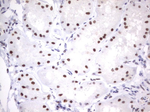 PARN Antibody in Immunohistochemistry (Paraffin) (IHC (P))