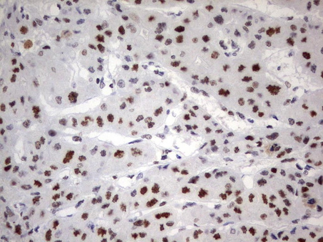 PARN Antibody in Immunohistochemistry (Paraffin) (IHC (P))