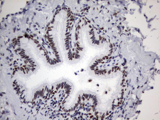 PARN Antibody in Immunohistochemistry (Paraffin) (IHC (P))