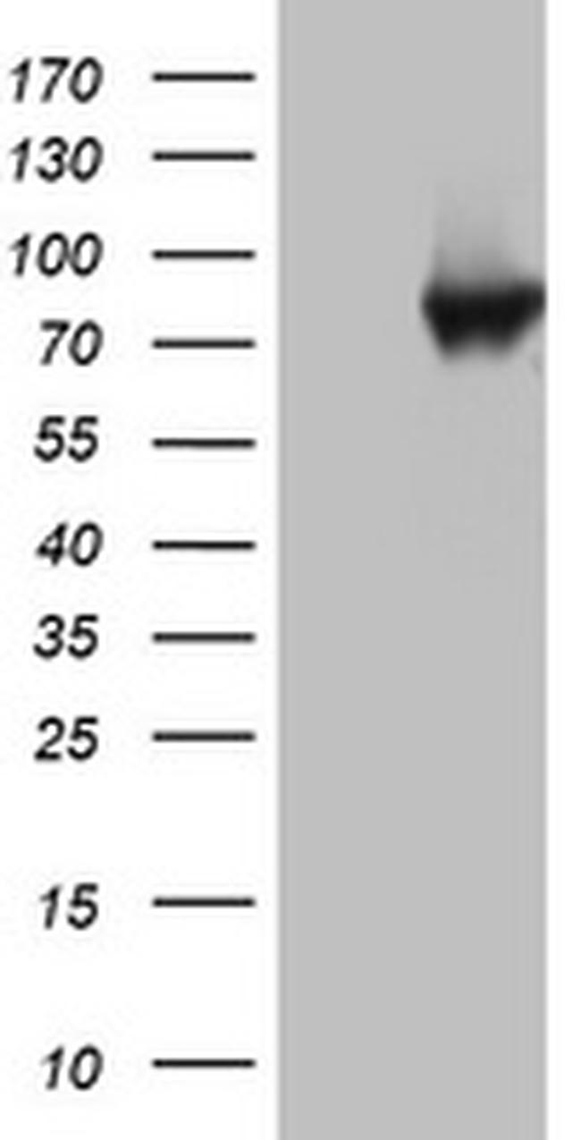 PARN Antibody in Western Blot (WB)