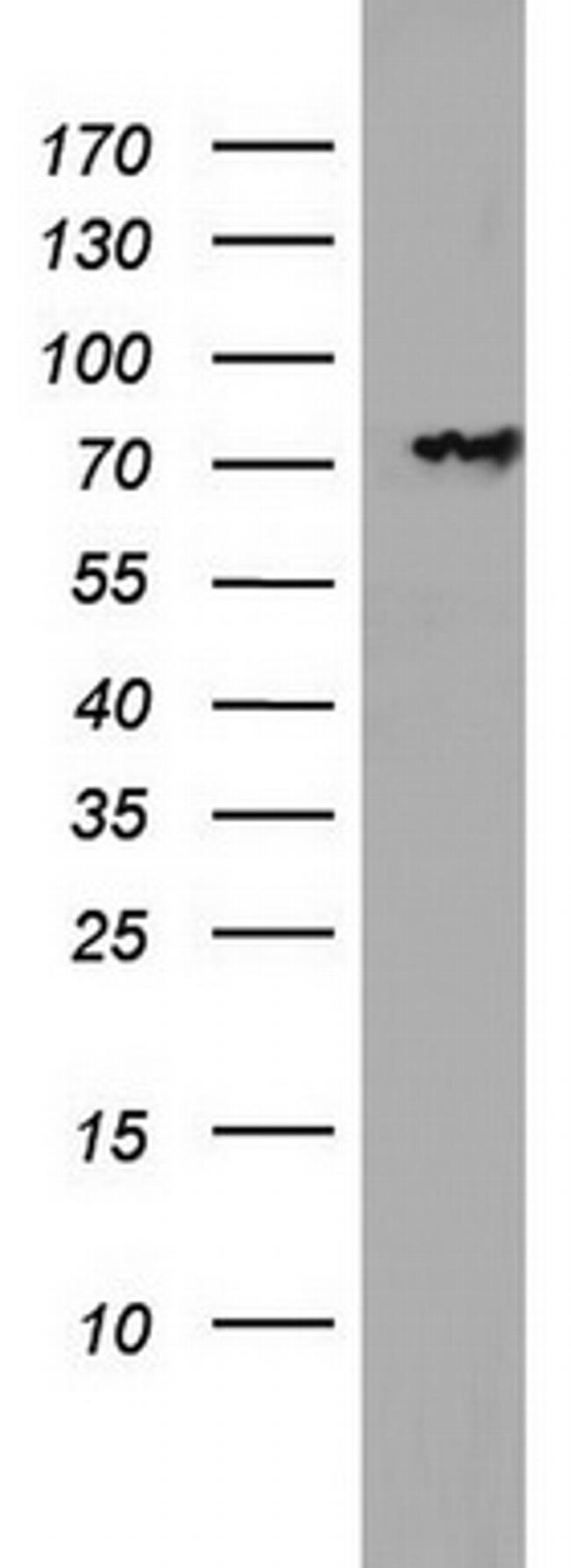 PARN Antibody in Western Blot (WB)