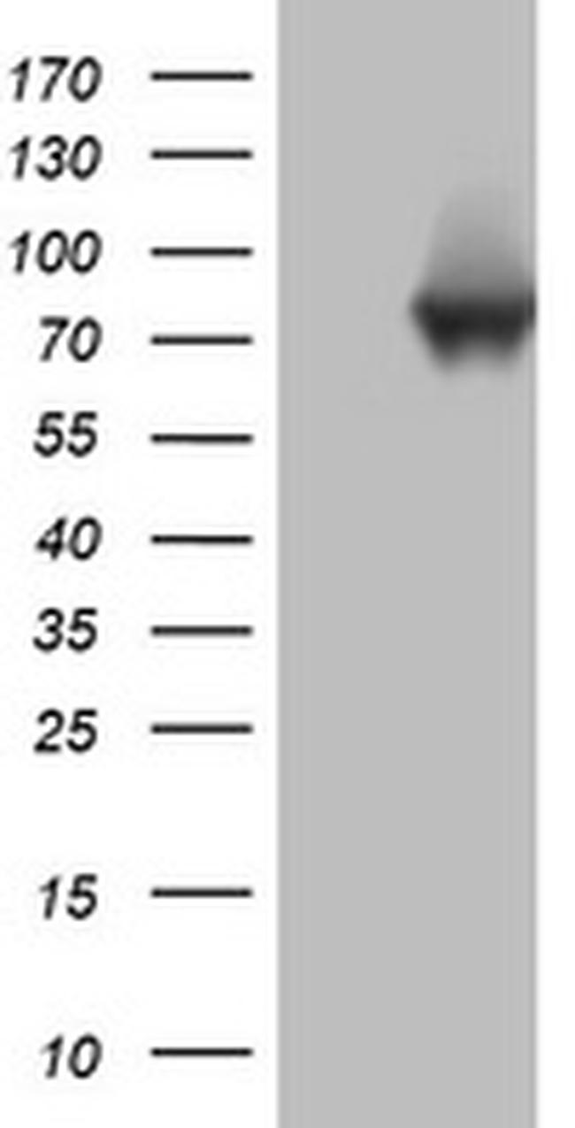 PARN Antibody in Western Blot (WB)