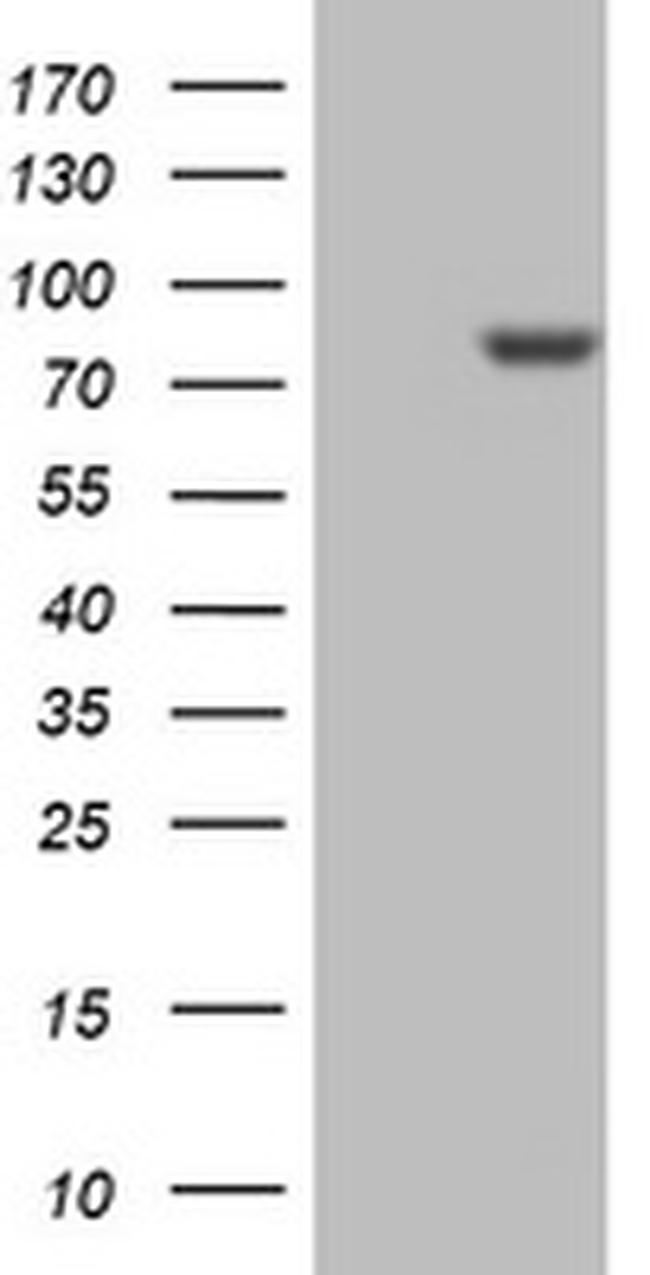 PARN Antibody in Western Blot (WB)