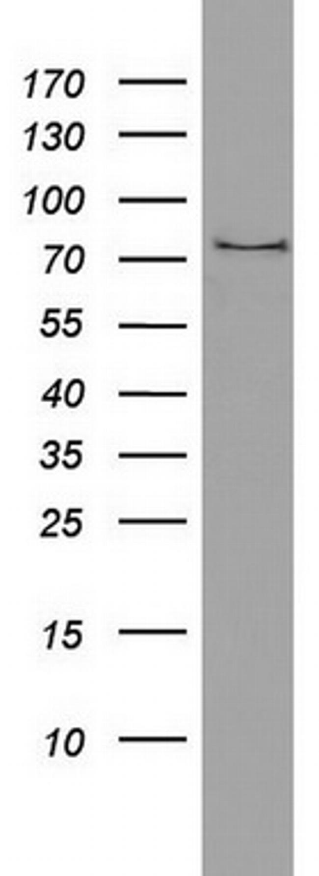 PARN Antibody in Western Blot (WB)