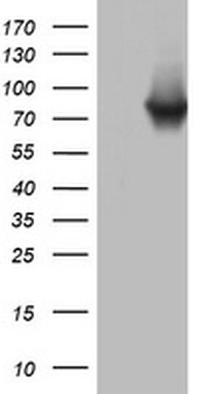 PARN Antibody in Western Blot (WB)