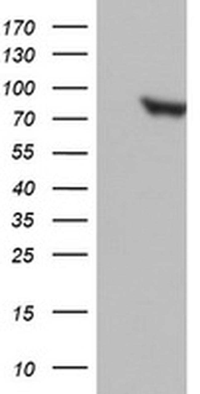 PARN Antibody in Western Blot (WB)