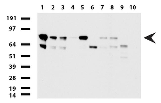 PARN Antibody in Western Blot (WB)