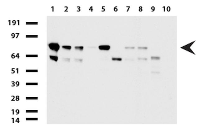 PARN Antibody in Western Blot (WB)