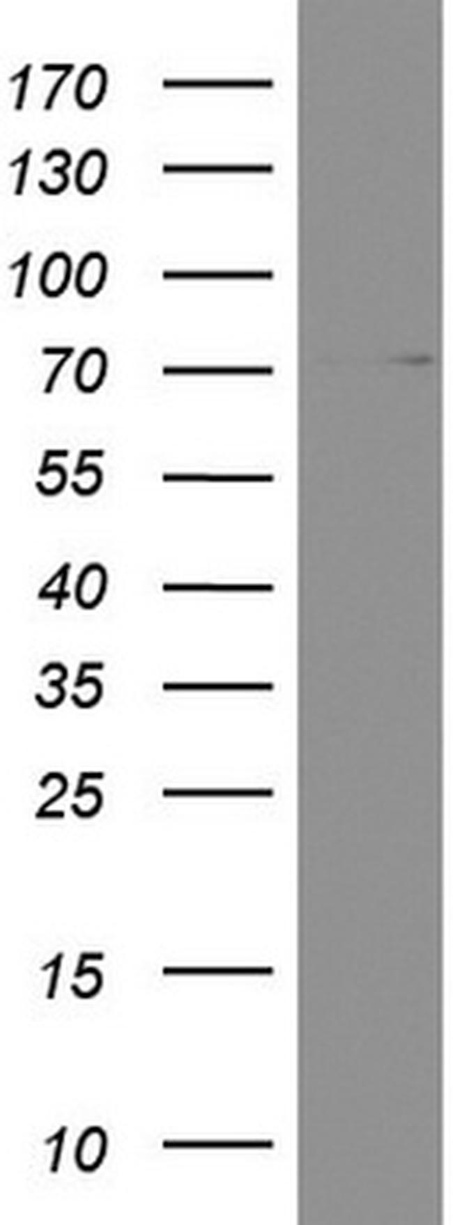 PARN Antibody in Western Blot (WB)