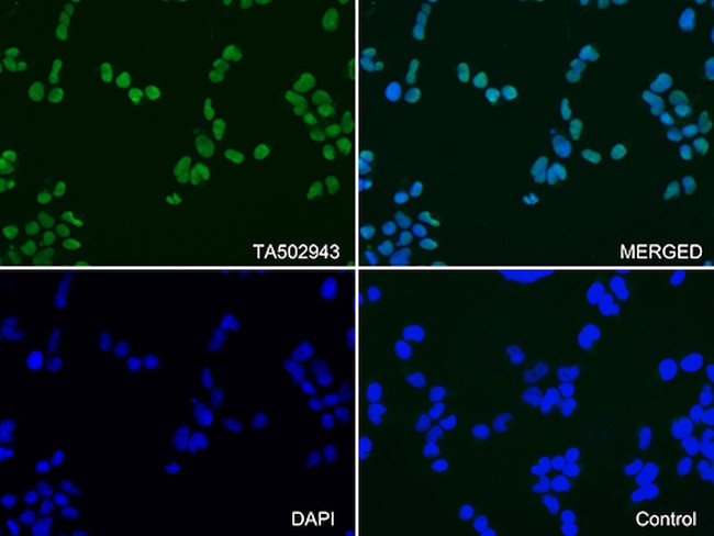 PARP1 Antibody in Immunocytochemistry (ICC/IF)