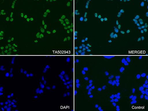 PARP1 Antibody in Immunocytochemistry (ICC/IF)