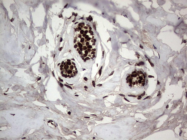 PARP1 Antibody in Immunohistochemistry (Paraffin) (IHC (P))