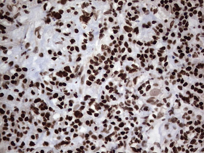 PARP1 Antibody in Immunohistochemistry (Paraffin) (IHC (P))