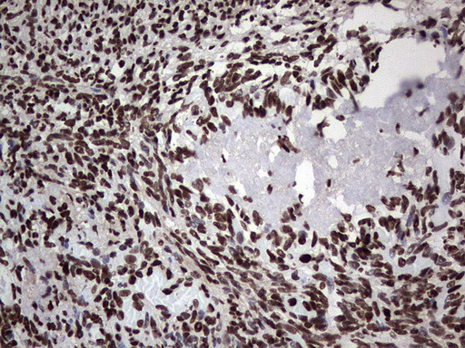 PARP1 Antibody in Immunohistochemistry (Paraffin) (IHC (P))