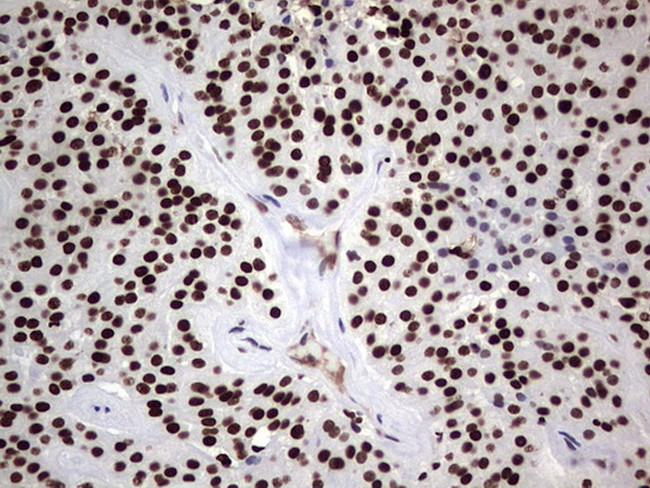 PARP1 Antibody in Immunohistochemistry (Paraffin) (IHC (P))