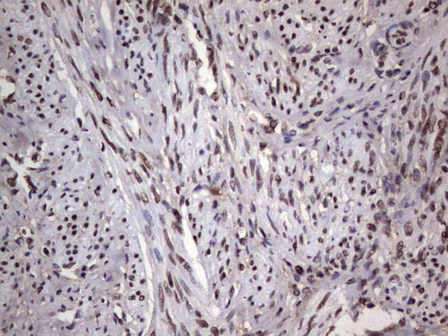 PARP1 Antibody in Immunohistochemistry (Paraffin) (IHC (P))