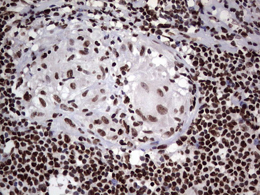 PARP1 Antibody in Immunohistochemistry (Paraffin) (IHC (P))