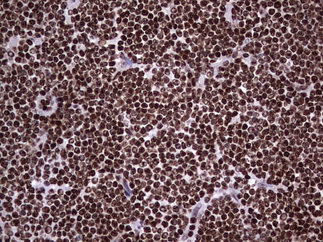 PARP1 Antibody in Immunohistochemistry (Paraffin) (IHC (P))