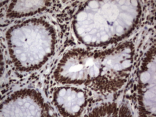 PARP1 Antibody in Immunohistochemistry (Paraffin) (IHC (P))