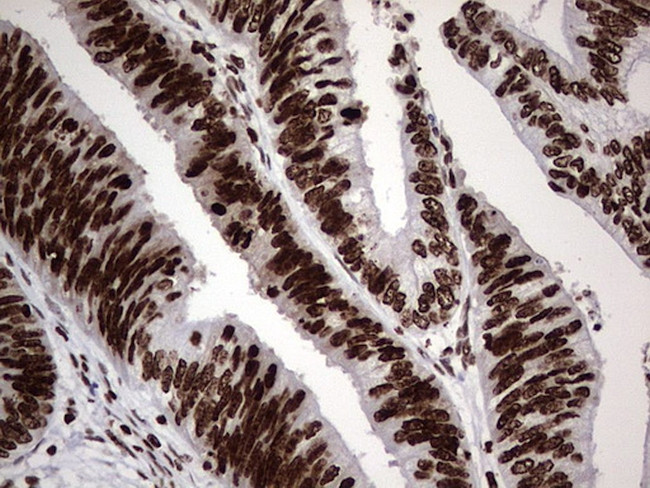 PARP1 Antibody in Immunohistochemistry (Paraffin) (IHC (P))