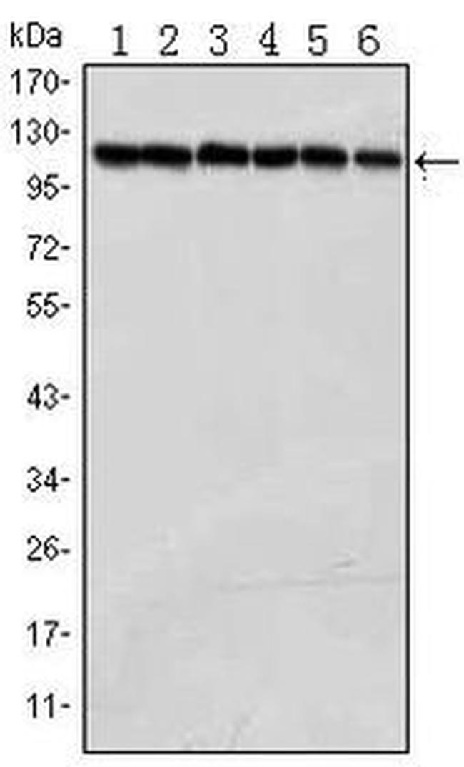 PARP1 Antibody in Western Blot (WB)