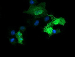 PARVA Antibody in Immunocytochemistry (ICC/IF)