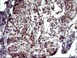 PARVA Antibody in Immunohistochemistry (Paraffin) (IHC (P))