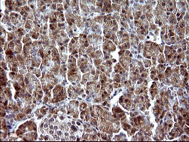 PARVA Antibody in Immunohistochemistry (Paraffin) (IHC (P))