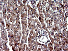 PARVA Antibody in Immunohistochemistry (Paraffin) (IHC (P))