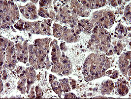 PARVA Antibody in Immunohistochemistry (Paraffin) (IHC (P))