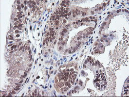 PARVA Antibody in Immunohistochemistry (Paraffin) (IHC (P))