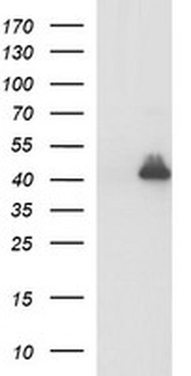 PARVA Antibody in Western Blot (WB)