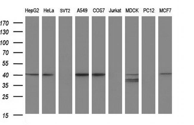 PARVA Antibody in Western Blot (WB)