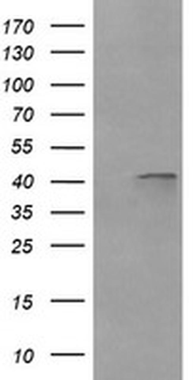 PARVA Antibody in Western Blot (WB)