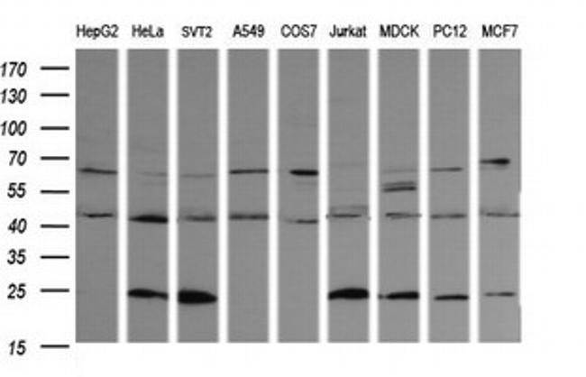 PARVA Antibody in Western Blot (WB)