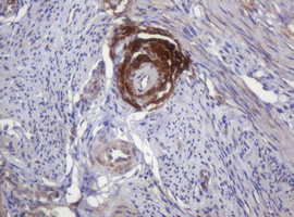 PARVB Antibody in Immunohistochemistry (Paraffin) (IHC (P))