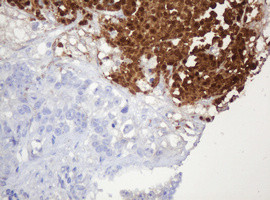 PARVB Antibody in Immunohistochemistry (Paraffin) (IHC (P))