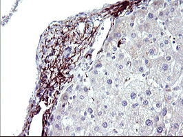 PARVB Antibody in Immunohistochemistry (Paraffin) (IHC (P))