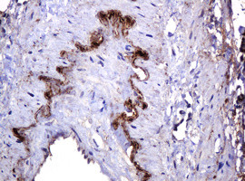 PARVB Antibody in Immunohistochemistry (Paraffin) (IHC (P))