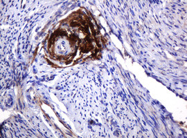 PARVB Antibody in Immunohistochemistry (Paraffin) (IHC (P))