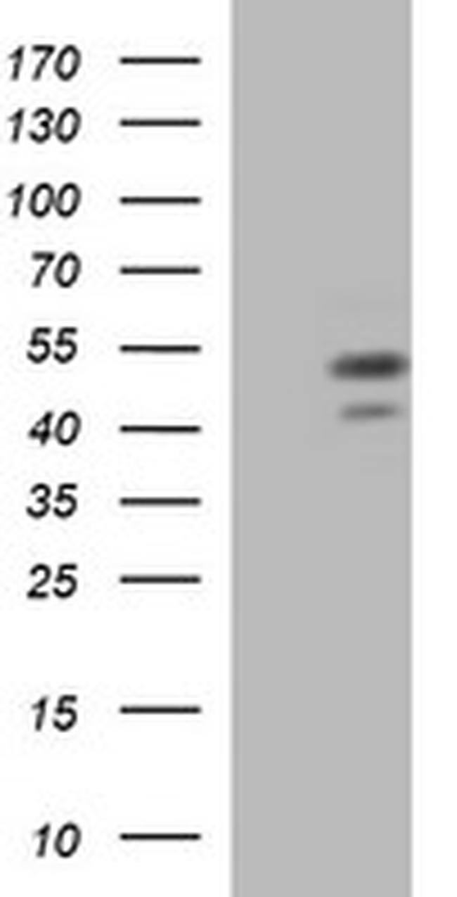 PARVB Antibody in Western Blot (WB)