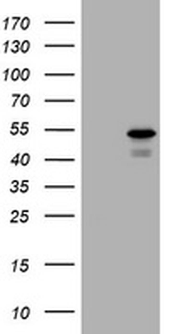 PARVB Antibody in Western Blot (WB)