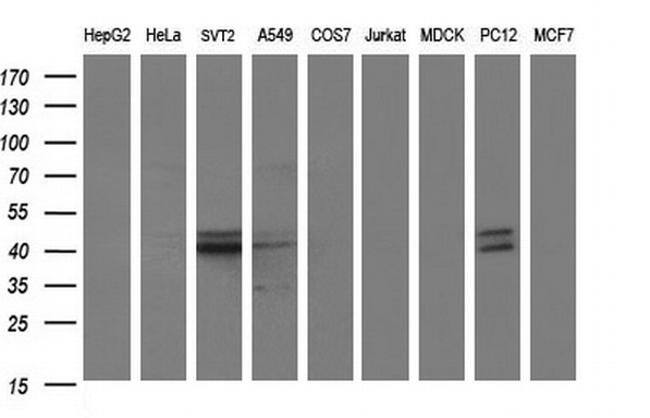 PARVB Antibody in Western Blot (WB)