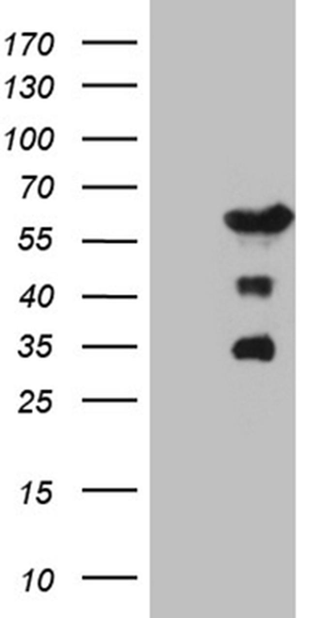 PATZ1 Antibody in Western Blot (WB)