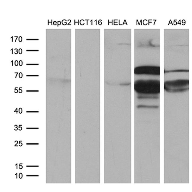 PATZ1 Antibody in Western Blot (WB)