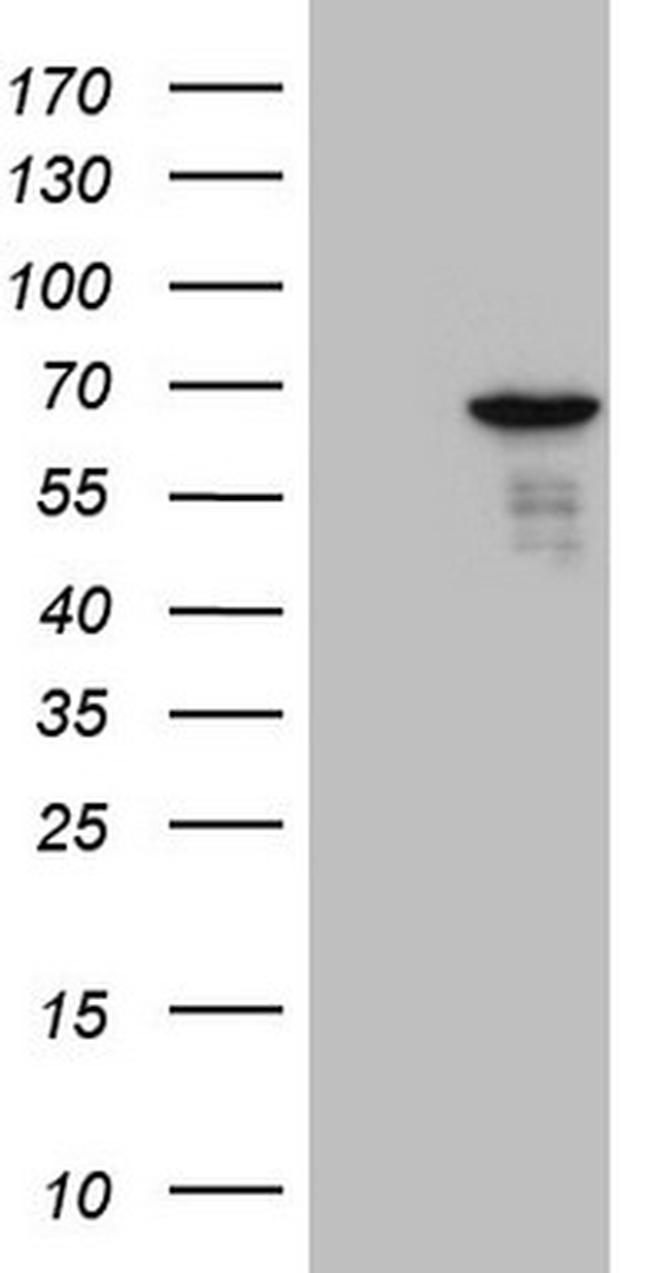 PATZ1 Antibody in Western Blot (WB)