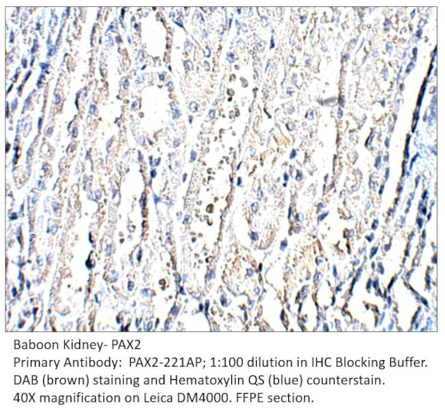 Pax2 Antibody in Immunohistochemistry (IHC)