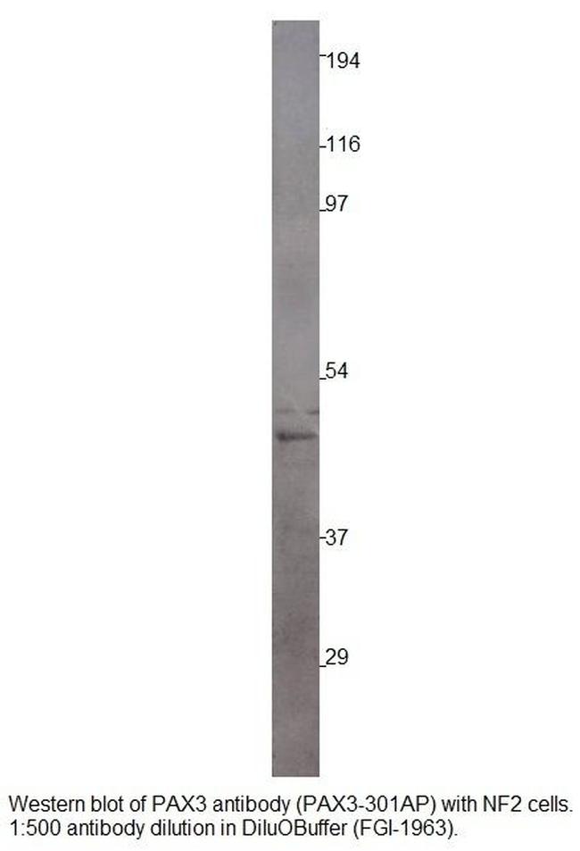 PAX3 Antibody in Western Blot (WB)