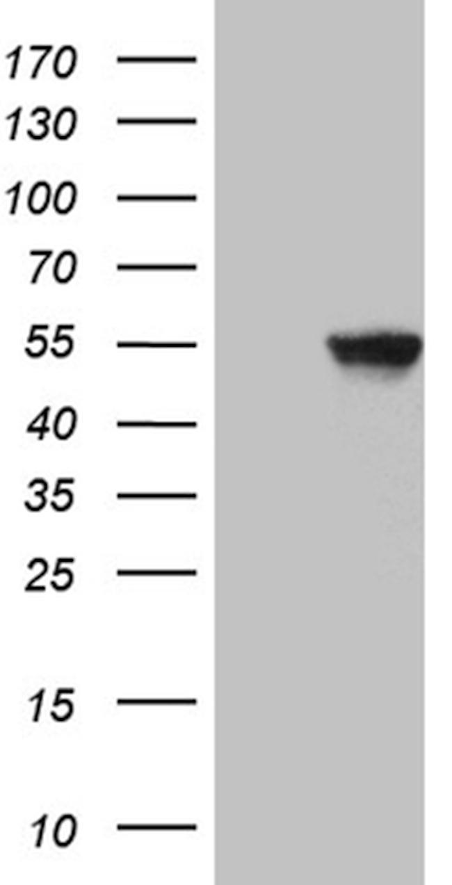 PAX3 Antibody in Western Blot (WB)